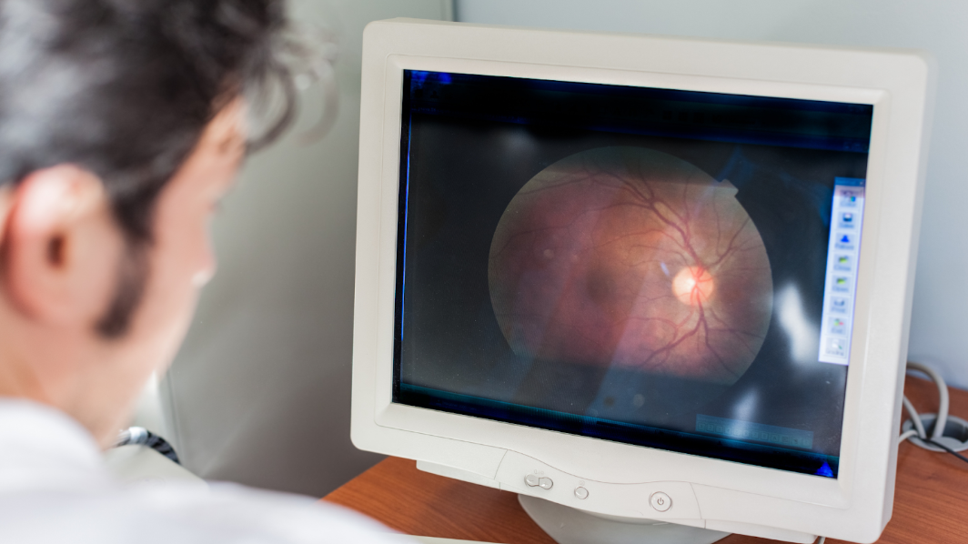 Retinal Imaging Toronto